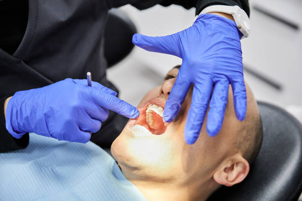 Best Emergency Treatment for Dental Infections or Abscesses in Hansville, WA