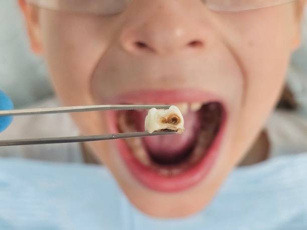 Best Pediatric Emergency Dentist in Hansville, WA